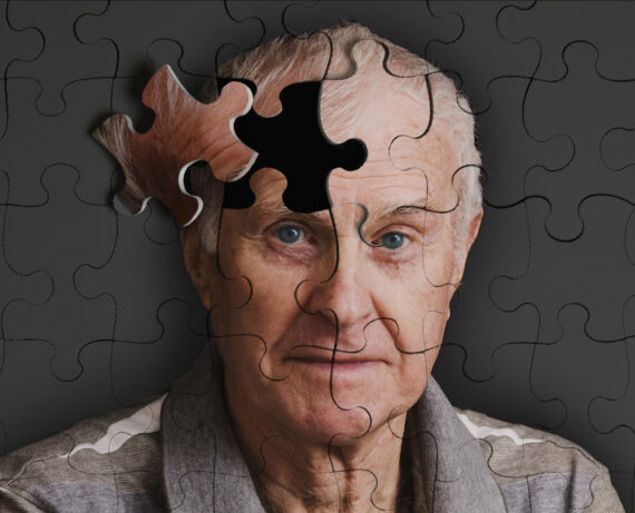 Curso Técnicas de Estimulación Cognitiva en Pacientes de Alzheimer y otras demencias